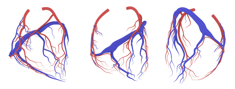 image of 3D coronary vessels